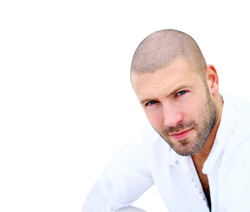 Hombre con tratamiento de pigmentación capilar realizado en nuestra clínica de injerto capilar