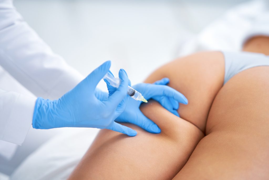 Mesoterapia corporal en la zona baja del glúteo en la clínica de Sevilla
