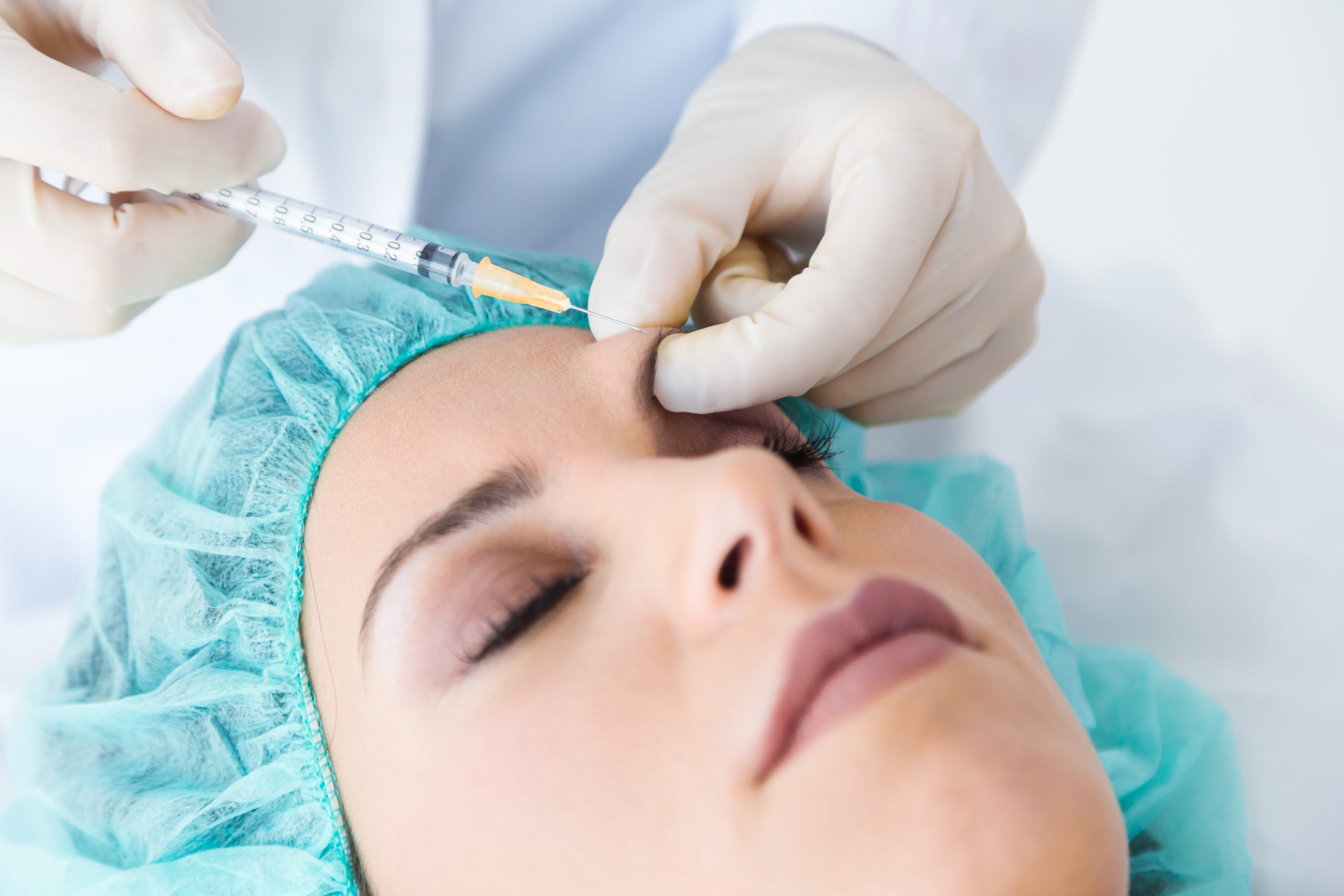 Procedimiento de aplicación de Botox en Sevilla. Una aguja expertamente administrada en la frente de una paciente, destacando nuestro tratamiento de Botox para suavizar arrugas y rejuvenecer la piel.
