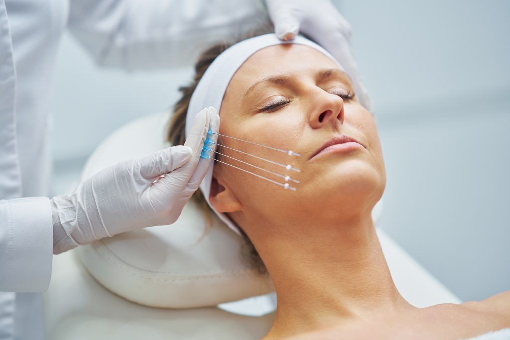 Mujer recibiendo tratamiento de hilos tensores para rejuvenecimiento facial