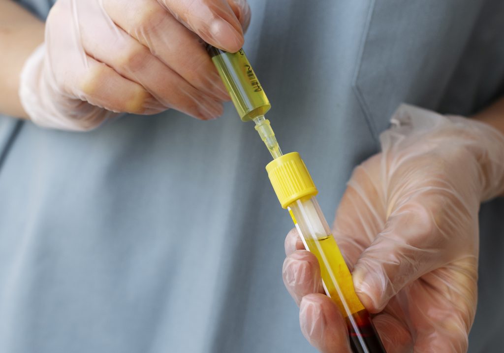 profesional capilar preparando tratamiento prp